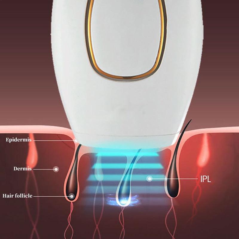 Depilador a Laser Definitivo Importado/LaserDepil